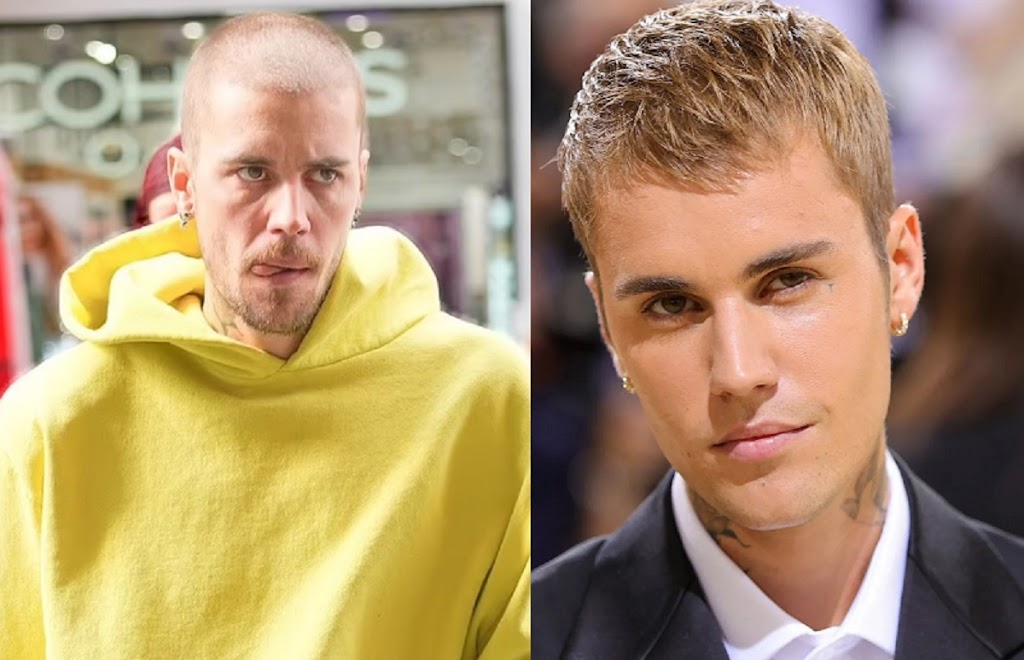 Scruffy Justin Bieber: ஜஸ்டின் பீபரா இது: எப்படி இருந்த நான் இப்படி ஆகிட்டேன் பாலியல் நோய் காரணமா ?